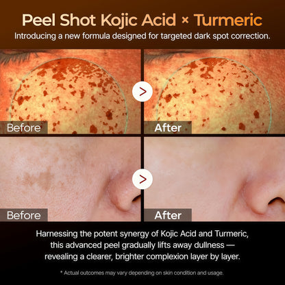 Turmeric-Cal Brightening Repair Kit