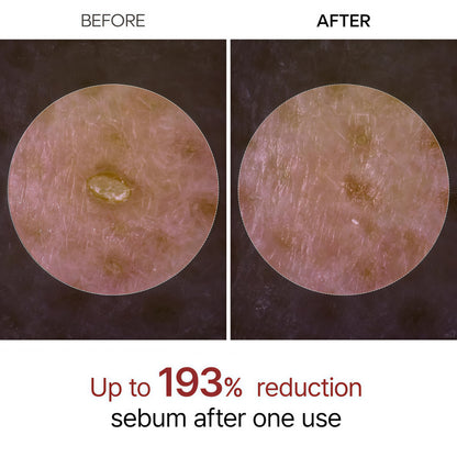 Peel Shot Exfoliating Glow Rice Line